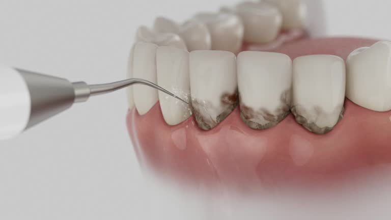 Trusted Teeth Cleaning And Checkup service in Fresno, CA - Dentist Open Now